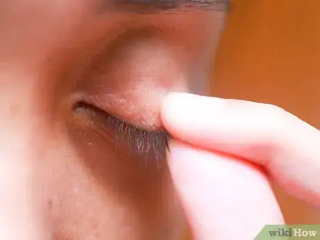 Imagen titulada Flip Eyelids Inside Out Step 1