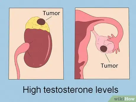 Imagen titulada Lower Testosterone Levels Step 8