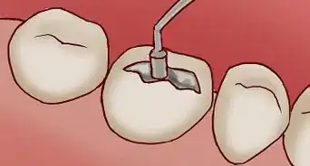 enderezar tus dientes sin frenillos