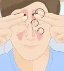 aliviar el dolor y la irritación de la nariz después de sonarse frecuentemente
