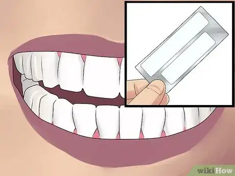 Imagen titulada Whiten Teeth With Hydrogen Peroxide Step 3