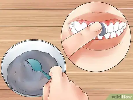 Imagen titulada Get Rid of White Spots on Teeth Step 2