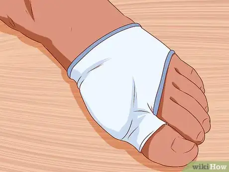 Imagen titulada Relieve Bunions Step 4