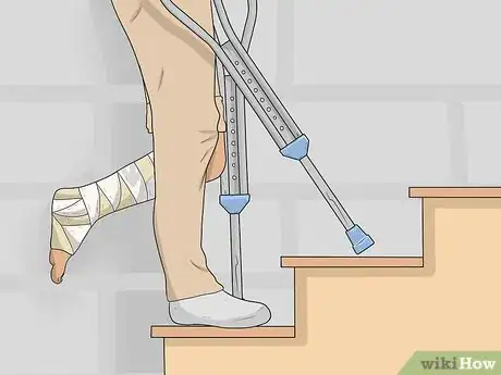 Imagen titulada Go Upstairs with Crutches Step 4