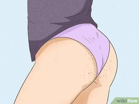 Imagen titulada Get Rid of Acne on the Buttocks Step 2