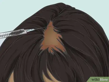 Imagen titulada Grow Hair Back After a Scalp Fungal Infection Step 7