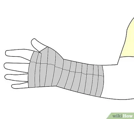 Imagen titulada Wrap a Wrist Step 19