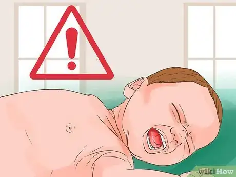 Imagen titulada Identify Symptoms of Jaundice Step 11