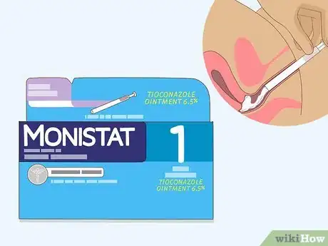 Imagen titulada Apply Monistat Step 11