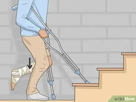 Imagen titulada Go Upstairs with Crutches Step 3