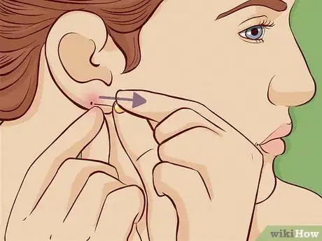 Imagen titulada Close an Earlobe Piercing Step 1