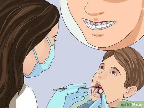 Imagen titulada Get Your Braces off Faster Step 1