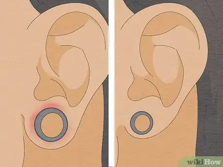 Imagen titulada Stretch Your Ears Pain Free Step 10