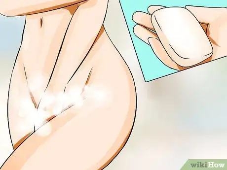 Imagen titulada Cure Vaginal Infections Without Using Medications Step 31