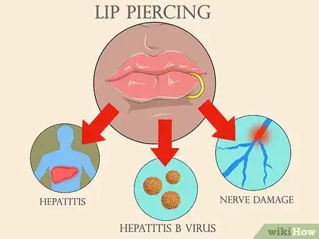 Imagen titulada Convince Your Parents to Let You Get a Lip Ring Step 8