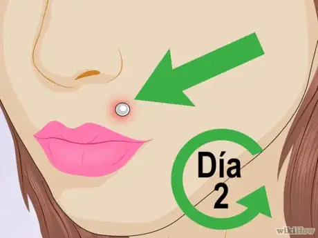 Imagen titulada Tell_if_a_Piercing_Is_Infected_Step_1