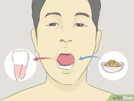 Imagen titulada Eat After a Tooth Extraction Step 5