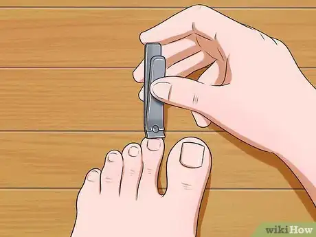 Imagen titulada Prevent Nail Fungus Step 2