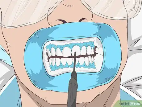 Imagen titulada Remove Tea Stains from Teeth Step 7