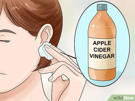 Imagen titulada Get Rid of Pimples Inside the Ear Step 14