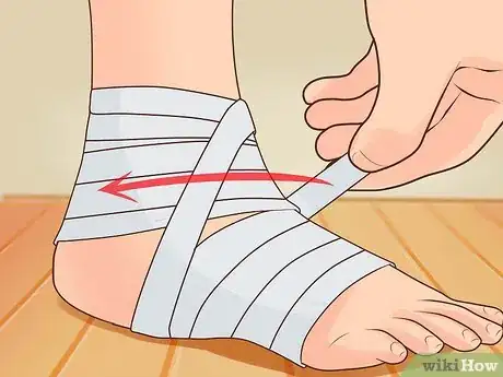 Imagen titulada Wrap an Ankle Step 9