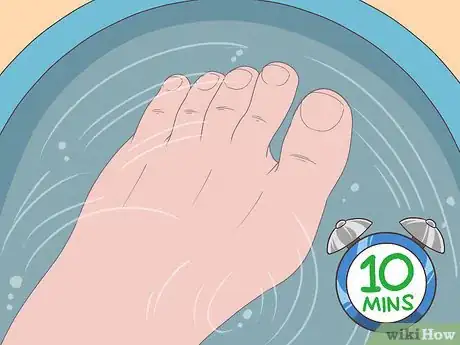 Imagen titulada Trim Toenails with Fungus Step 1