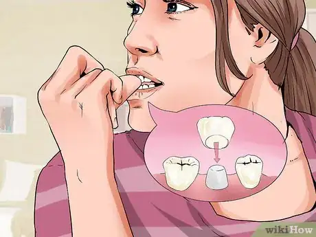 Imagen titulada Avoid Dental Crown Problems Step 2