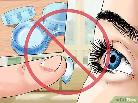 Imagen titulada Heal a Scratched Cornea Step 11