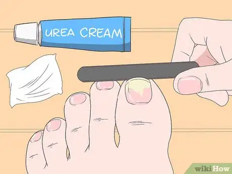 Imagen titulada Trim Toenails with Fungus Step 2