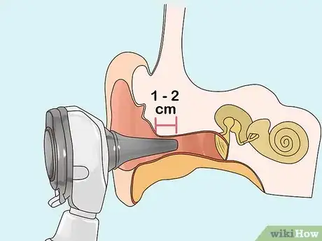 Imagen titulada Use an Otoscope Step 7