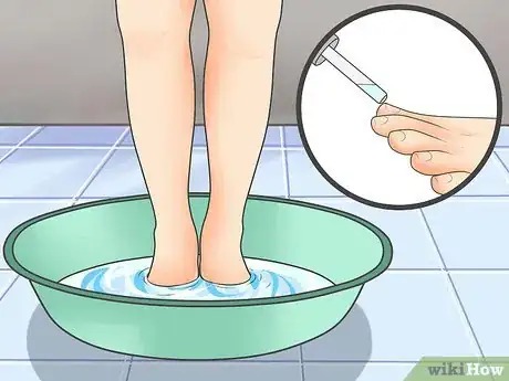 Imagen titulada Tell if You Have an Ingrown Toenail Step 6