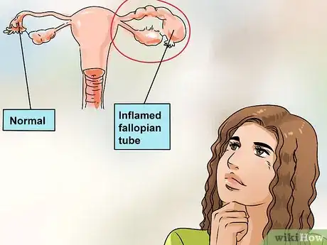 Imagen titulada Cure Vaginal Infections Without Using Medications Step 10