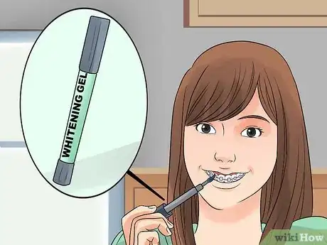 Imagen titulada Whiten Your Teeth when You Have Braces Step 6