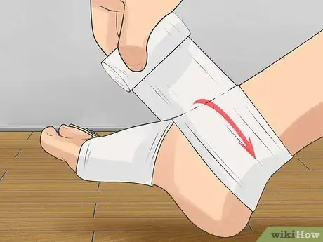 Imagen titulada Fix Achilles Tendonitis Step 5