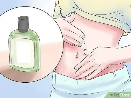 Imagen titulada Get Rid of a Skin Rash Caused by Antibiotic Allergy Step 10