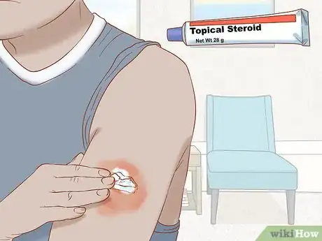 Imagen titulada Treat a Burn from an Iron Step 11