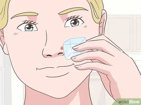 Imagen titulada Get Rid of a Pimple Step 9