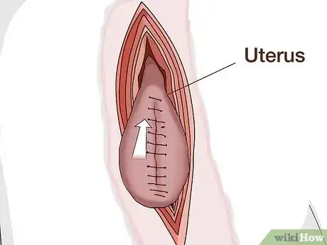 Imagen titulada Perform a Caesarean Section on a Cow or Heifer Step 16