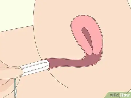 Imagen titulada Insert a Tampon Without Applicator Step 6