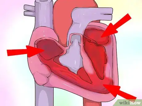 Imagen titulada Interpret Echocardiograms Step 5