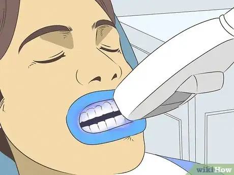 Imagen titulada Fix Nicotine Stained Teeth Step 7