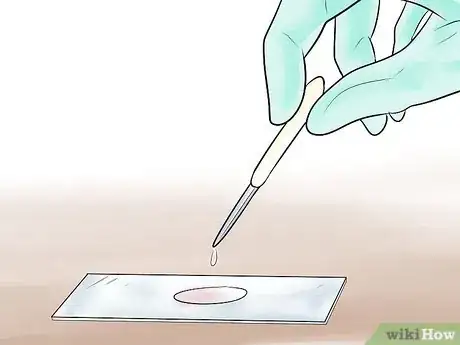 Imagen titulada Gram Stain Step 3