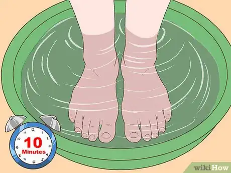 Imagen titulada Fix Thick Toenails Step 1