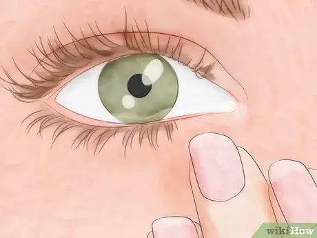 Imagen titulada Know if You Have Eye Mites Step 1