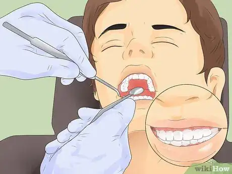 Imagen titulada Get Rid of White Spots on Teeth Step 7