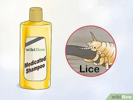 Imagen titulada Get Rid of an Itchy Scalp Step 6