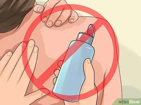 Imagen titulada Get Rid of Heat Rash Step 7