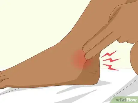 Imagen titulada Recognize Gout Symptoms Step 3