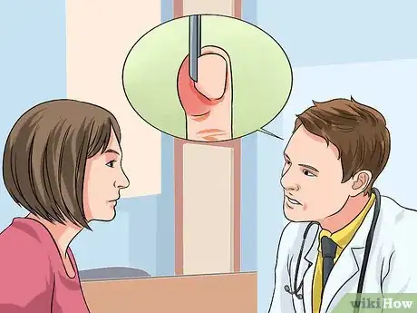 Imagen titulada Treat an Ingrown Fingernail Step 10