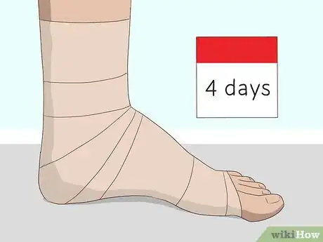 Imagen titulada Wrap an Ankle with an ACE Bandage Step 11